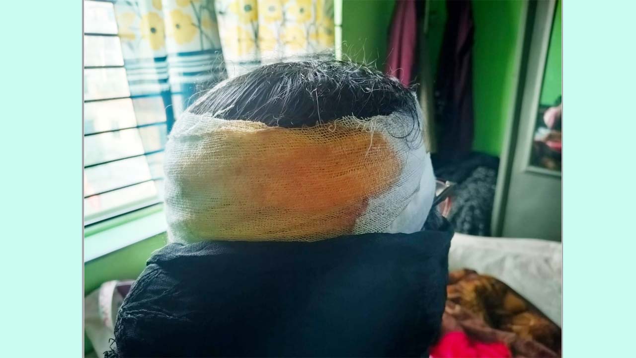 কদমতলীতে জামায়াতের নারী নেত্রীকে কুপিয়ে আহত করার অভিযোগ