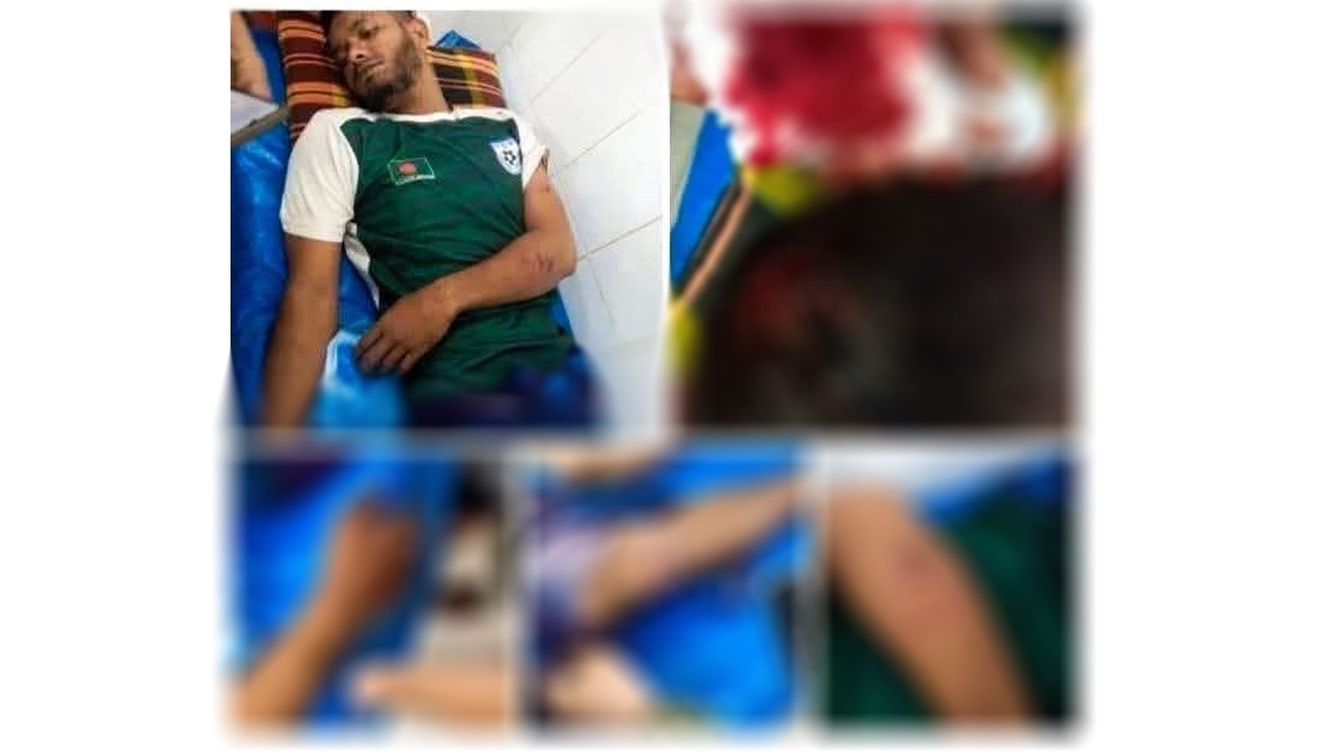 ভেদরগঞ্জ উপজেলায় মাদক ও ইভটিজিং এর প্রতিবাদ করায় যুবদল নেতার উপর কিশোর গ্যাং এর হামলা