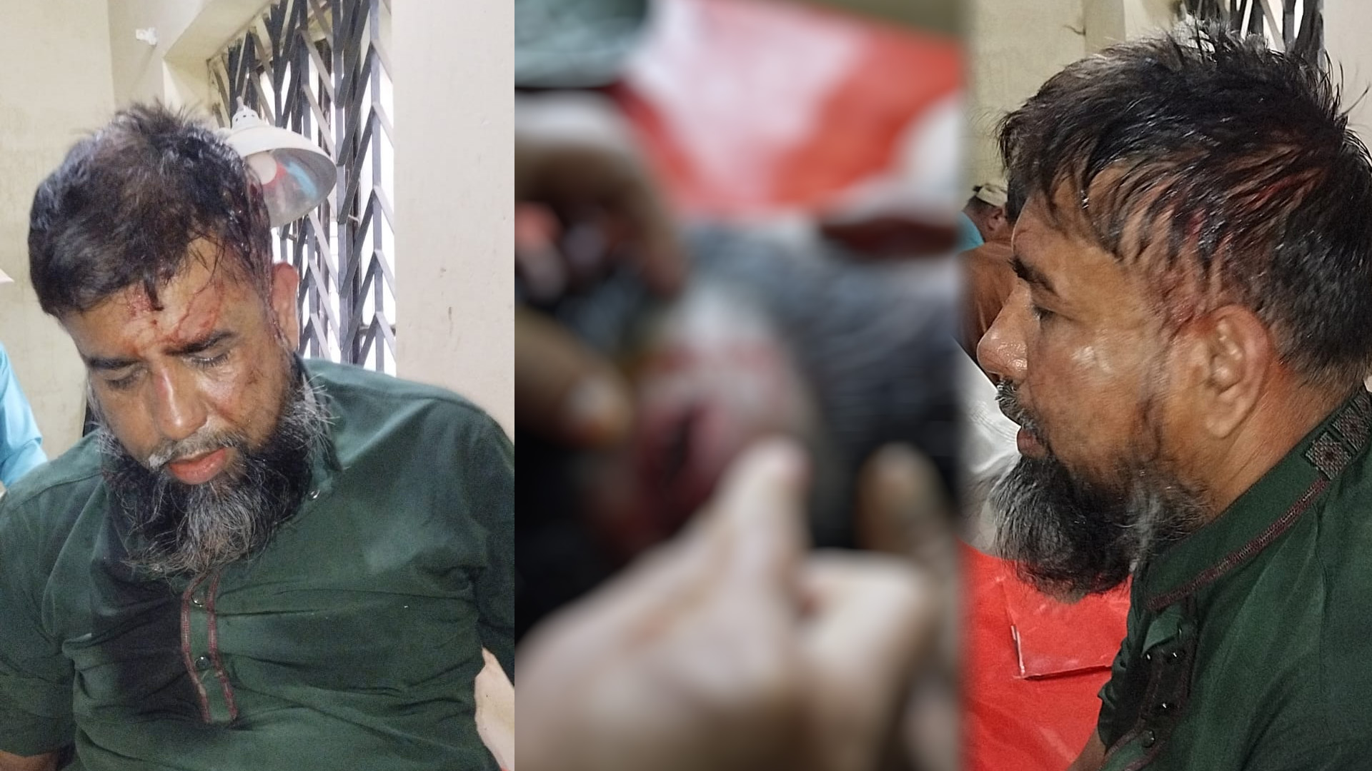 পানছড়িতে জামায়াত আমিরের ওপর হামলা: বিএনপি নেতাকর্মীদের বিরুদ্ধে অভিযোগ