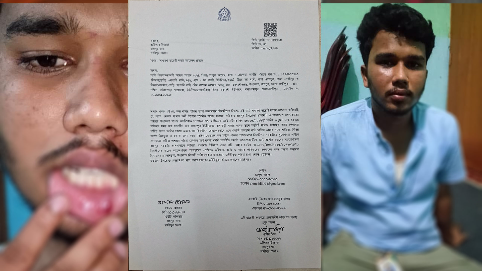 রায়পুরে সাংবাদিক এর উপর হামলা ও মারধরের অভিযোগ উঠেছে।