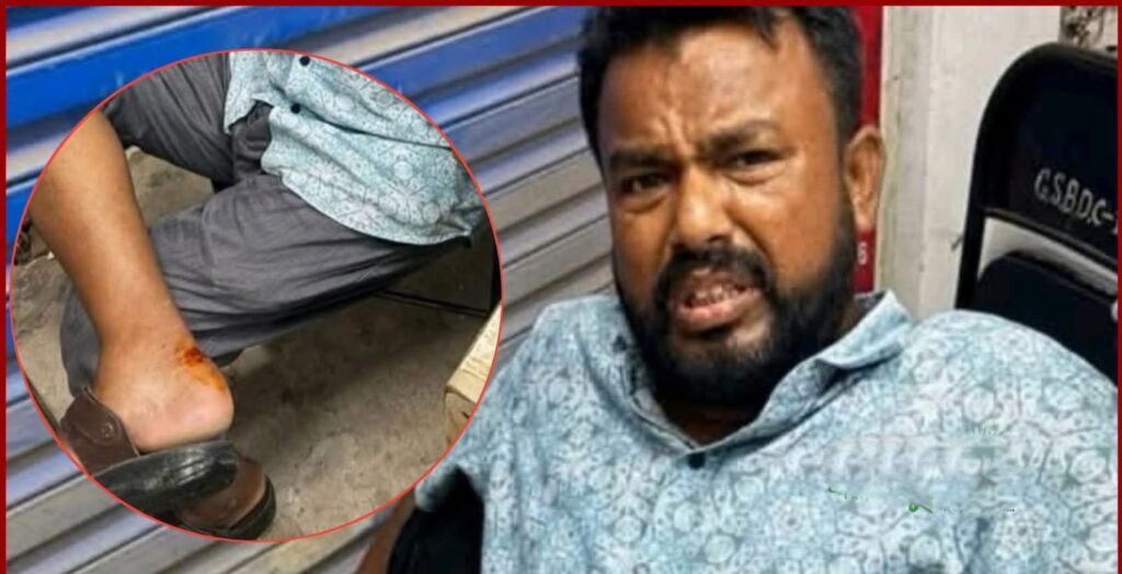 রাসেল ভাইপারের থাবা: চিকিৎসাধীন অবস্থায় যুবদল নেতার মৃত্যু.!